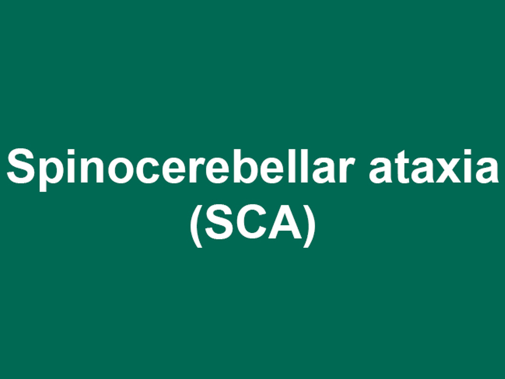 Umbraco.Cms.Infrastructure.PublishedCache.Property