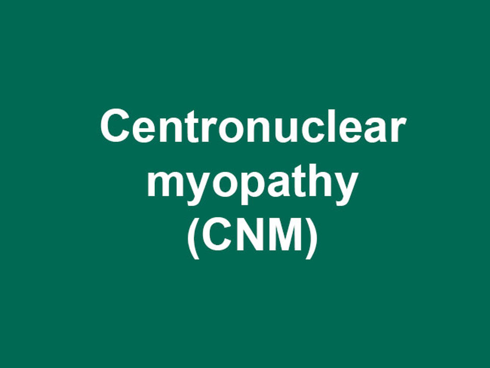 Umbraco.Cms.Infrastructure.PublishedCache.Property