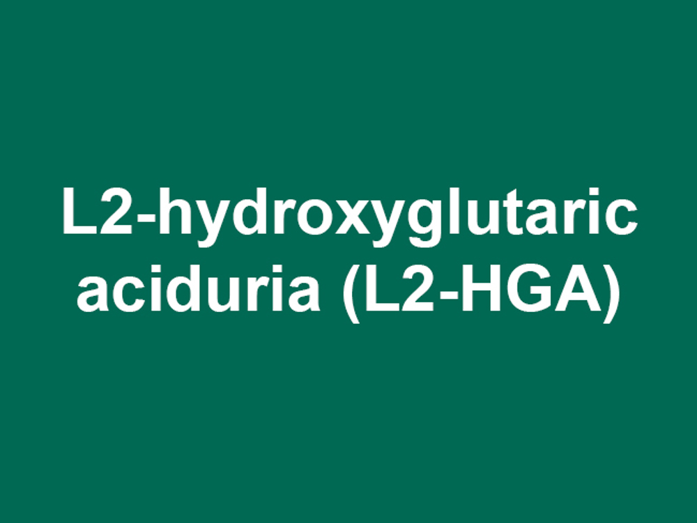 Umbraco.Cms.Infrastructure.PublishedCache.Property