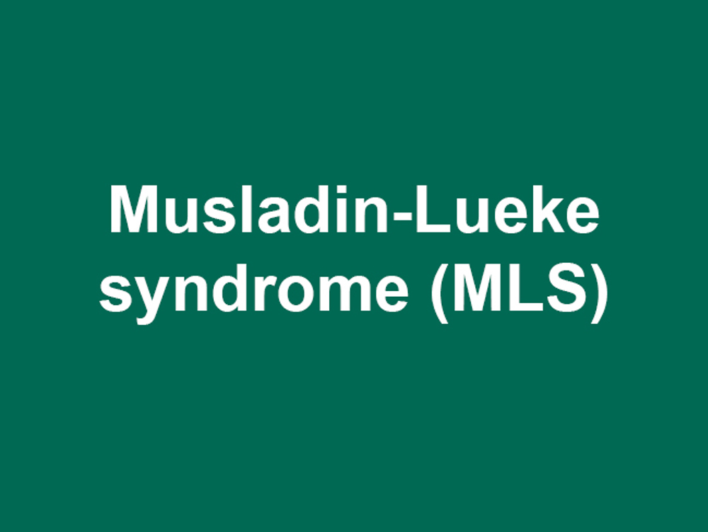 Umbraco.Cms.Infrastructure.PublishedCache.Property