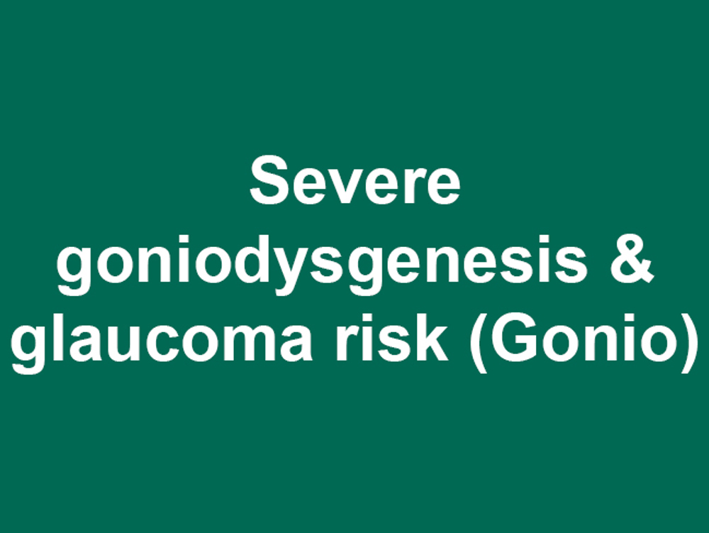 Umbraco.Cms.Infrastructure.PublishedCache.Property