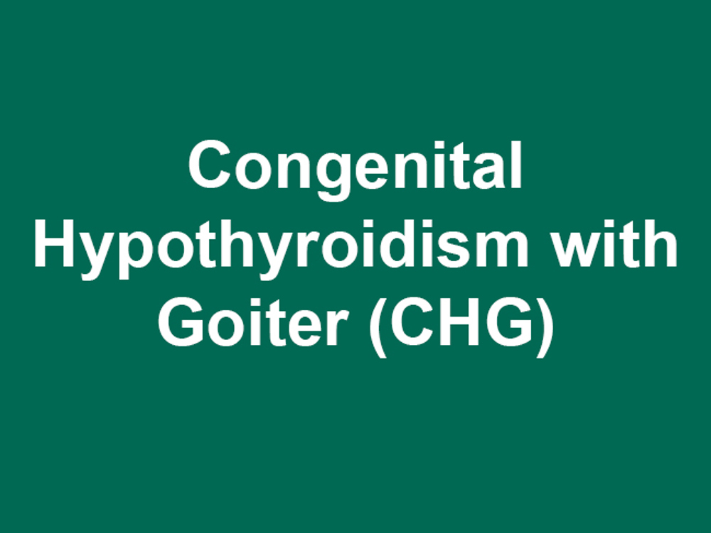 Umbraco.Cms.Infrastructure.PublishedCache.Property