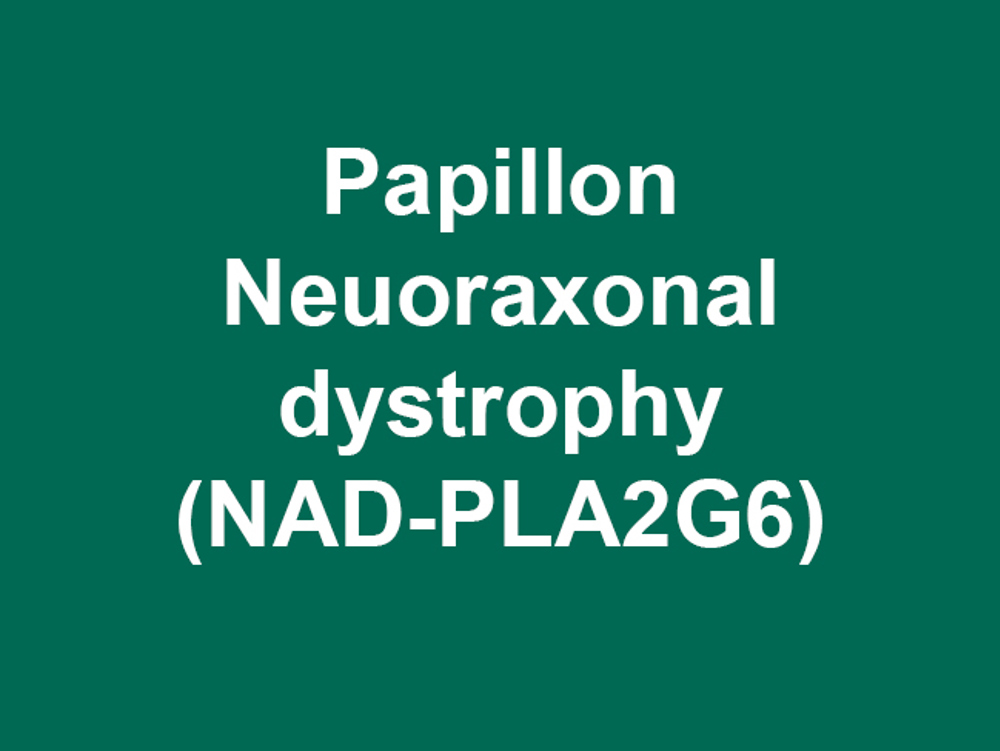 Umbraco.Cms.Infrastructure.PublishedCache.Property