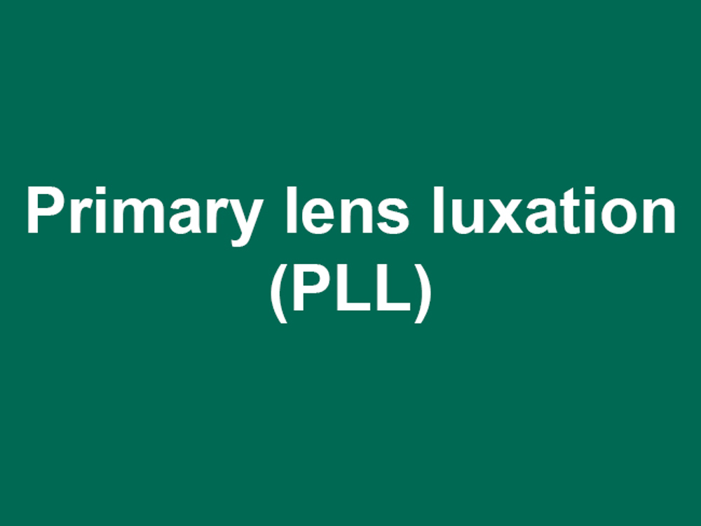 Umbraco.Cms.Infrastructure.PublishedCache.Property