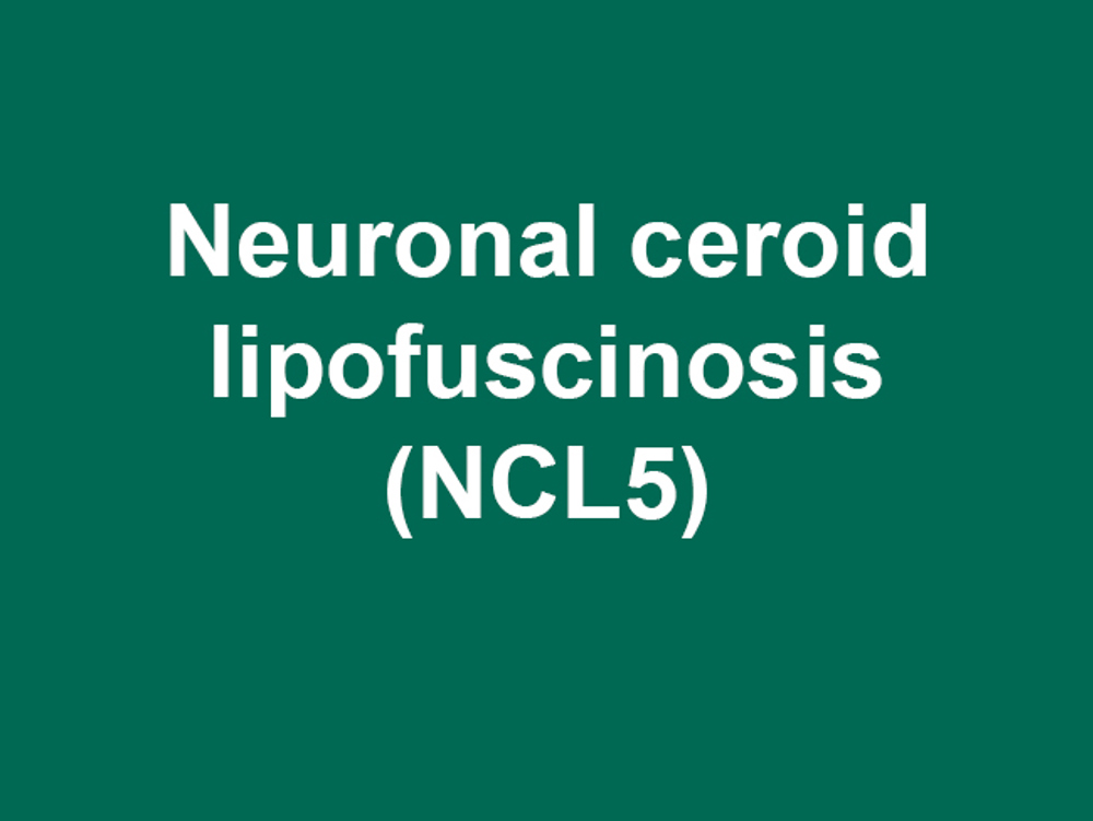 Umbraco.Cms.Infrastructure.PublishedCache.Property