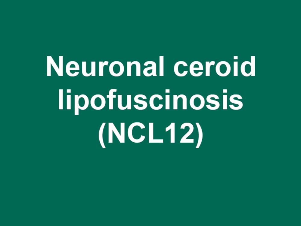 Umbraco.Cms.Infrastructure.PublishedCache.Property